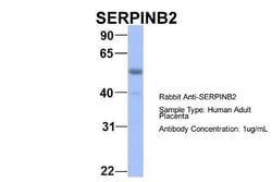 SerpinB2 Antibody, Novus Biologicals 100&mu;L; Unlabeled:Antibodies, Polyclonal