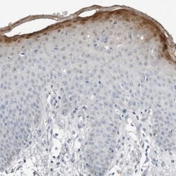 SerpinB7 Antibody, Novus Biologicals 0.1mL; Unlabeled:Antibodies, Polyclonal