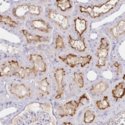 Serum Amyloid A4 Antibody, Novus Biologicals:Antibodies:Primary Antibodies