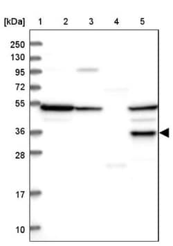 Serine Dehydratase Antibody, Novus Biologicals:Antibodies:Primary Antibodies