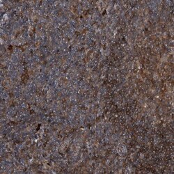 Sin1/MAPKAP1 Antibody, Novus Biologicals:Antibodies:Primary Antibodies