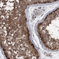 Sin1/MAPKAP1 Antibody, Novus Biologicals:Antibodies:Primary Antibodies