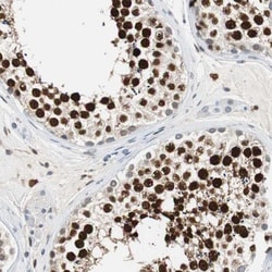 Sirtuin 1/SIRT1 Antibody, Novus Biologicals 0.1mL; Unlabeled:Antibodies,