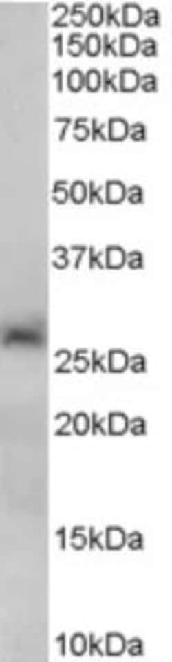 Sirtuin 3/SIRT3 Antibody, Novus Biologicals 0.1mg; Unlabeled:Antibodies,