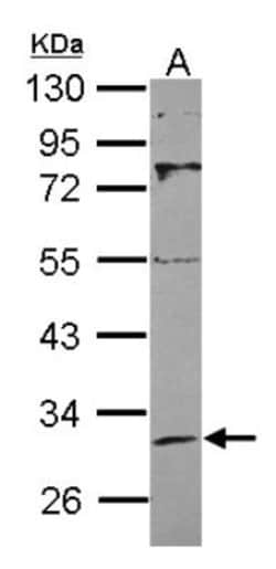 Sirtuin 3/SIRT3 Antibody, Novus Biologicals 0.1mL; Unlabeled:Antibodies,