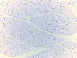 Novus Biologicals Skeletal Muscle Tissue Slides (Adult Normal)- Paraffin 5 portaobjetos | Buy Online | Novus Biologicals&trade; | Fisher Scientific