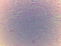 Novus Biologicals&trade;&nbsp;Skin Tissue Slides (Adult Normal)- Paraffin