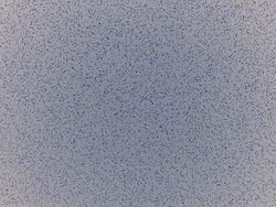 Novus Biologicals Skin Tissue Slides (Fibrosarcoma)- Paraffin 5 Slides | Buy Online | Novus Biologicals&trade; | Fisher Scientific