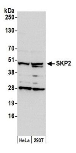 Skp2 Antibody, Novus Biologicals 0.1mL; Unlabeled:Antibodies, Polyclonal