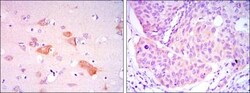 Smad5 Antibody (3H9), Novus Biologicals 0.1mL; Unlabeled:Antibodies, Monoclonal