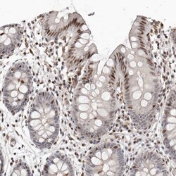 Smad7 Antibody, Novus Biologicals 0.1mL; Unlabeled:Antibodies, Polyclonal