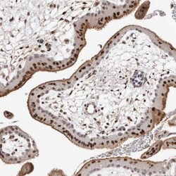 Smad7 Antibody, Novus Biologicals 0.1mL; Unlabeled:Antibodies, Polyclonal