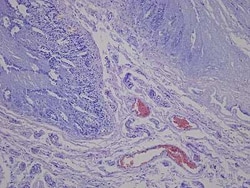 Novus Biologicals Small Intestine Jejunum Tissue Slides (Diabetes)- Paraffin 5 Slides | Buy Online | Novus Biologicals&trade; | Fisher Scientific