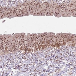 SmarcAL1 Antibody, Novus Biologicals 25 &mu;L, Unlabeled:Antibodies, Polyclonal