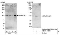 SmarcAL1 Antibody, Novus Biologicals 0.1mL; Unlabeled:Antibodies, Polyclonal