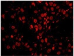 Smek1 Antibody, Novus Biologicals 0.1mL; Unlabeled:Antibodies, Polyclonal