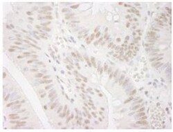 Smek1 Antibody, Novus Biologicals 0.1mL; Unlabeled:Antibodies, Polyclonal