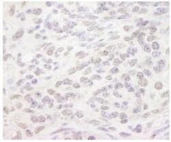 Smek1 Antibody, Novus Biologicals 0.1mL; Unlabeled:Antibodies, Polyclonal