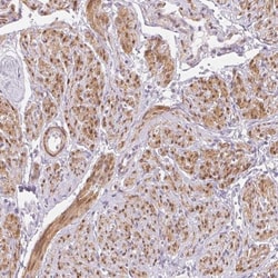 Smoothelin Antibody, Novus Biologicals 25 &mu;L, Unlabeled:Antibodies,