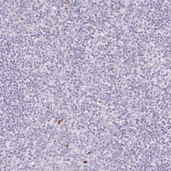Smoothelin Antibody, Novus Biologicals 25 &mu;L, Unlabeled:Antibodies,