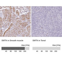 Smoothelin Antibody, Novus Biologicals 25 &mu;L, Unlabeled:Antibodies,