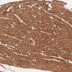 Smoothelin Antibody, Novus Biologicals 0.1mL; Unlabeled:Antibodies, Polyclonal