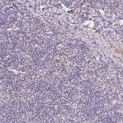 Smoothelin Antibody, Novus Biologicals 0.1mL; Unlabeled:Antibodies, Polyclonal