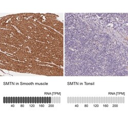 Smoothelin Antibody, Novus Biologicals 0.1mL; Unlabeled:Antibodies, Polyclonal