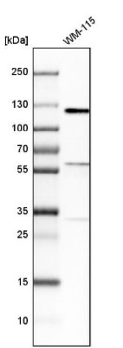 Smoothelin Antibody, Novus Biologicals 25 &mu;L, Unlabeled:Antibodies,