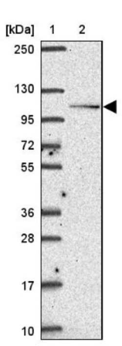 Smoothelin Antibody, Novus Biologicals 0.1mL; Unlabeled:Antibodies, Polyclonal