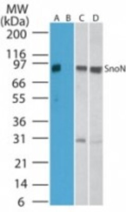 SnoN Antibody, Novus Biologicals 0.025mg; Unlabeled:Antibodies, Polyclonal