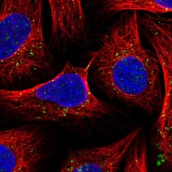 Snx6 Antibody, Novus Biologicals:Antibodies:Primary Antibodies