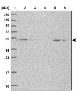 Snx6 Antibody, Novus Biologicals:Antibodies:Primary Antibodies
