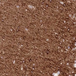 Sodium Potassium ATPase Alpha 3 Antibody, Novus Biologicals 0.1mL; Unlabeled:Antibodies,