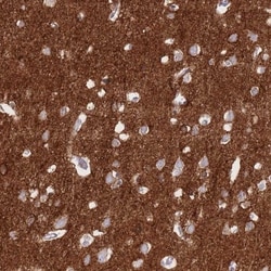 Sodium Potassium ATPase Alpha 3 Antibody, Novus Biologicals 0.1mL; Unlabeled:Antibodies,