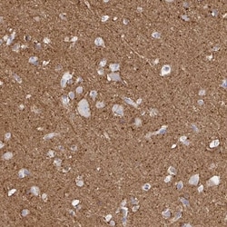 Sodium Potassium ATPase Alpha 3 Antibody, Novus Biologicals:Antibodies:Primary