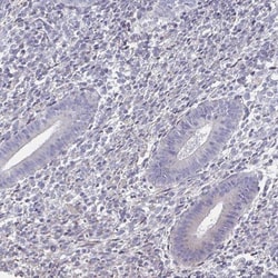 Sodium Potassium ATPase Alpha 3 Antibody, Novus Biologicals:Antibodies:Primary