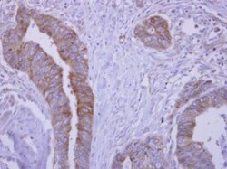 Soluble Liver/Pancreas Antigen Antibody, Novus Biologicals 0.1mL; Unlabeled:Antibodies,