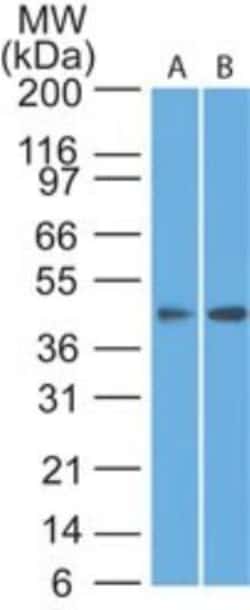 Somatostatin R1/SSTR1 Antibody, Novus Biologicals 0.025mg; Unlabeled:Antibodies,