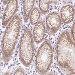 Somatostatin R4/SSTR4 Antibody, Novus Biologicals:Antibodies:Primary Antibodies