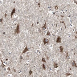 Sortilin Antibody, Novus Biologicals:Antibodies:Primary Antibodies