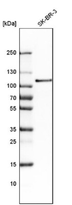 Sortilin Antibody, Novus Biologicals:Antibodies:Primary Antibodies