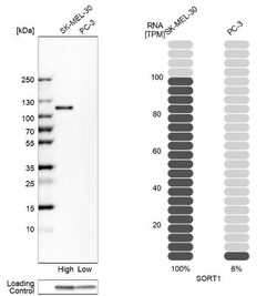 Sortilin Antibody, Novus Biologicals:Antibodies:Primary Antibodies