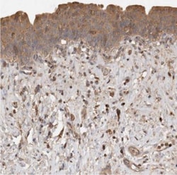 Sorting Nexin 31 Antibody, Novus Biologicals 0.1mL; Unlabeled:Antibodies,