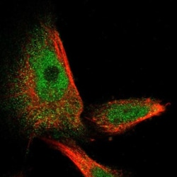 Spastin Antibody, Novus Biologicals 25 &mu;L | Buy Online | Novus Biologicals | Fisher Scientific