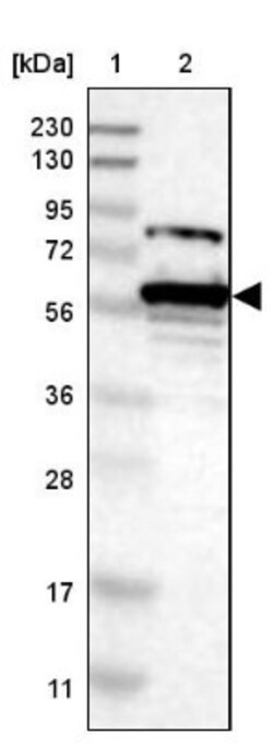 Spastin Antibody, Novus Biologicals 25 &mu;L | Buy Online | Novus Biologicals | Fisher Scientific