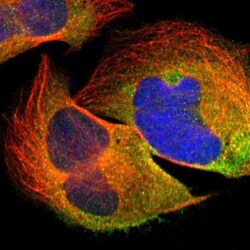 Spectrin beta 1 Antibody, Novus Biologicals 0.1mL; Unlabeled:Antibodies,