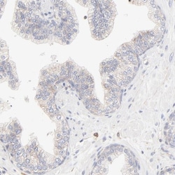 Spectrin beta 1 Antibody, Novus Biologicals:Antibodies:Primary Antibodies