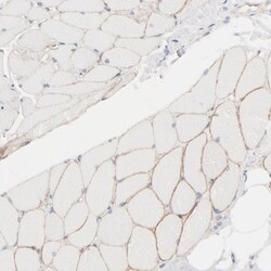 Spectrin beta 1 Antibody, Novus Biologicals:Antibodies:Primary Antibodies