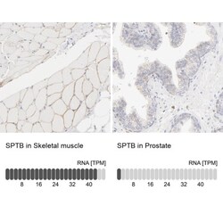 Spectrin beta 1 Antibody, Novus Biologicals:Antibodies:Primary Antibodies
